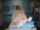 Me before surgery